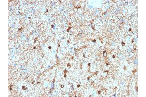 Formalin-fixed, paraffin-embedded human Cerebellum stained with GFAP Mouse Monoclonal Antibody (GFAP/2076). (GFAP anticorps  (AA 101-200))