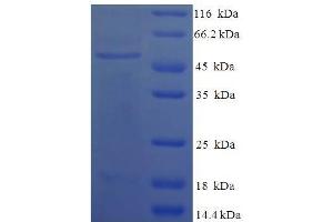 SDS-PAGE (SDS) image for Complement Component C4b (C4b) (AA 1454-1744) protein (His-SUMO Tag) (ABIN5710718)