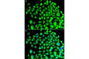 Immunofluorescence analysis of A549 cell using TBPL1 antibody. (TBPL1 anticorps)