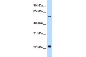 Western Blotting (WB) image for anti-Solute Carrier Family 17 (Acidic Sugar Transporter), Member 5 (SLC17A5) antibody (ABIN2462751) (Solute Carrier Family 17 (Acidic Sugar Transporter), Member 5 (SLC17A5) anticorps)