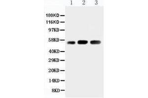 Anti-KIN antibody, Western blotting Lane 1: Rat Skeletal Muscle Tissue Lysate Lane 2: Human Placenta Tissue Lysate Lane 3: Rat Testis Tissue Lysate