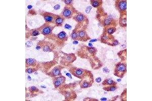 Immunohistochemical analysis of HAPLN1 staining in rat liver formalin fixed paraffin embedded tissue section.
