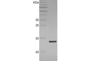 Western Blotting (WB) image for Fatty Acid Binding Protein 4, Adipocyte (FABP4) (AA 1-132) protein (His tag) (ABIN7122896)