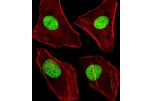Immunofluorescent analysis of 4 % paraformaldehyde-fixed, 0.