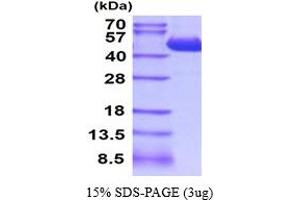 SDS-PAGE (SDS) image for Carboxypeptidase A4 (CPA4) (AA 17-421) protein (His tag) (ABIN5854528) (CPA4 Protein (AA 17-421) (His tag))