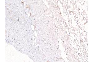 ABIN185030 Negative Control showing staining of paraffin embedded Human Kidney, with no primary antibody. (FOXD1 anticorps  (C-Term))