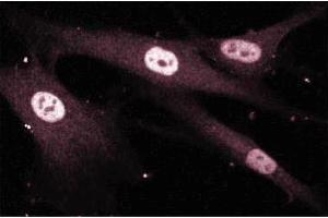 Immunofluroescence staining of Human Fibroblasts. (MEF2D anticorps  (AA 346-511))