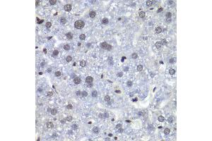 Immunohistochemistry of paraffin-embedded mouse liver using RBBP5 antibody at dilution of 1:100 (x40 lens). (RBBP5 anticorps)