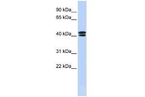 CACNB3 antibody used at 1 ug/ml to detect target protein. (CACNB3 anticorps  (N-Term))