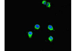 Immunofluorescent analysis of Hela cells using ABIN7160774 at dilution of 1:100 and Alexa Fluor 488-congugated AffiniPure Goat Anti-Rabbit IgG(H+L) (SMYD2A anticorps  (AA 115-272))