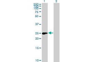 Western Blot analysis of ERAS expression in transfected 293T cell line by ERAS MaxPab polyclonal antibody. (ERAS anticorps  (AA 1-233))
