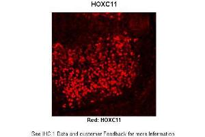 Immunohistochemistry (IHC) image for anti-Homeobox C11 (HOXC11) (Middle Region) antibody (ABIN2779771)