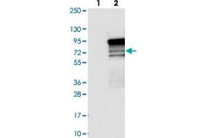 Western blot analysis of Lane 1: Negative control (vector only transfected HEK293T lysate). (TBC1D14 anticorps)