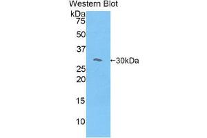 Western Blotting (WB) image for anti-Myosin IE (MYO1E) (AA 781-1036) antibody (ABIN1078393) (MYO1E anticorps  (AA 781-1036))