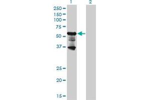 Western Blot analysis of PKNOX2 expression in transfected 293T cell line by PKNOX2 monoclonal antibody (M01), clone 4B6.