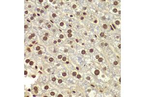 Immunohistochemistry of paraffin-embedded mouse liver using DDX5 antibody.