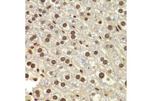 Immunohistochemistry of paraffin-embedded mouse liver using DDX5 antibody. (DDX5 anticorps  (AA 1-614))
