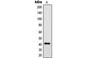 Western blot analysis of IgG1 expression in IgG recombinant protein (A). (Lapin anti-Humain IgG1 (Center) Anticorps)