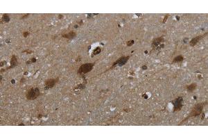 Immunohistochemistry of paraffin-embedded Human brain tissue using GLIPR1 Polyclonal Antibody at dilution 1:50