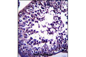 TSPYL5 Antibody (C-term) (ABIN657506 and ABIN2846530) immunohistochemistry analysis in formalin fixed and paraffin embedded human testis tissue followed by peroxidase conjugation of the secondary antibody and DAB staining.