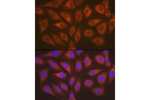Immunofluorescence analysis of U2OS cells using  antibody (ABIN7265552) at dilution of 1:100.