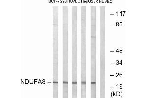 Western blot analysis of extracts from MCF-7 cells, 293 cells, HUVEC cells, HepG2 cells and Jurkat cells, using NDUFA8 antibody. (NDUFA8 anticorps  (Internal Region))