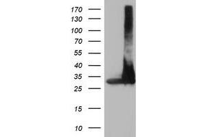 Western Blotting (WB) image for anti-Proteasome Subunit alpha 4 (PSMA4) antibody (ABIN1500458) (PSMA4 anticorps)