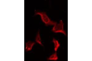 ABIN6278617 staining HuvEc by IF/ICC. (OR7C2 anticorps  (Internal Region))