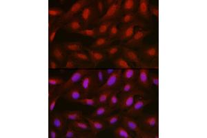 Immunofluorescence analysis of U2OS cells using [KO Validated]  Rabbit pAb (ABIN6133581 and ABIN6136917) at dilution of 1:100 (40x lens). (Annexin a1 anticorps)