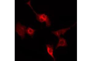 ABIN6269172 staining HeLa by IF/ICC. (SYN1 anticorps  (N-Term))