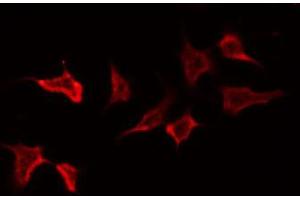 ABIN6272403 staining NIH-3T3 by IF/ICC. (PTPRN2 anticorps  (Internal Region))