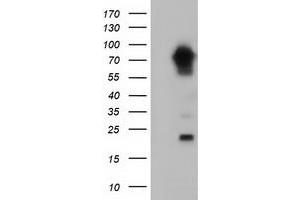 Western Blotting (WB) image for anti-Myotubularin Related Protein 14 (MTMR14) antibody (ABIN1499586) (MTMR14 anticorps)