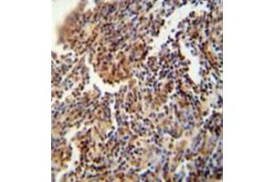 anti-HFM1, ATP-Dependent DNA Helicase Homolog (HFM1) (AA 1300-1329), (C-Term) antibody