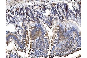 IHC analysis of TRIM16 using anti-TRIM16 antibody (ABIN7602226). (TRIM16 anticorps  (AA 65-210))