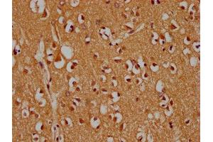IHC image of ABIN7159994 diluted at 1:300 and staining in paraffin-embedded human brain tissue performed on a Leica BondTM system.