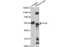 Western blot analysis of extracts of various cell lines, using PPAN Antibody (ABIN5975126) at 1/1000 dilution. (PPAN anticorps)