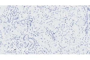 ABIN870670 Negative Control showing staining of paraffin embedded Human Kidney, with no primary antibody. (NPR3 anticorps  (AA 520-533))