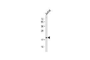 Anti-p19 Antibody (N-term) at 1:2000 dilution + Jurkat whole cell lysate Lysates/proteins at 20 μg per lane. (CDKN2D anticorps  (N-Term))