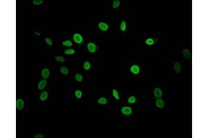 Immunofluorescent analysis of Hela cells using ABIN7139589 at dilution of 1:100 and Alexa Fluor 488-congugated AffiniPure Goat Anti-Rabbit IgG(H+L)