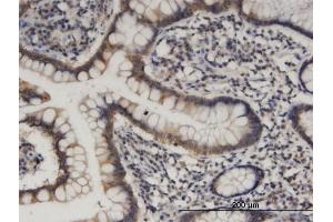 Immunoperoxidase of monoclonal antibody to HOOK1 on formalin-fixed paraffin-embedded human small Intestine.