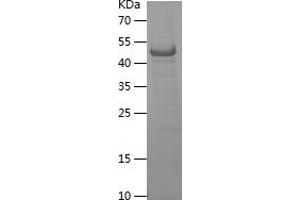 Western Blotting (WB) image for Integrin alpha 4 (ITGA4) (AA 790-1032) protein (His-IF2DI Tag) (ABIN7123466)