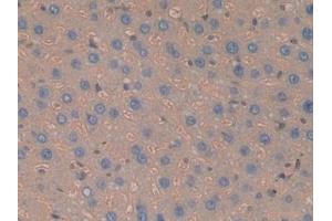 Detection of Hpt in Rat Liver Tissue using Polyclonal Antibody to Haptoglobin (Hpt) (Haptoglobin anticorps  (AA 70-332))