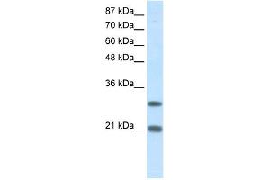 WB Suggested Anti-MSX2 Antibody Titration:  1. (Msx2/Hox8 anticorps  (N-Term))
