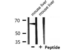 Western blot analysis of extracts from mouse liver, using GAD1 Antibody.