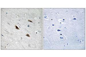 Immunohistochemistry (IHC) image for anti-Catenin, beta (CATNB) (pTyr489) antibody (ABIN1847544) (beta Catenin anticorps  (pTyr489))