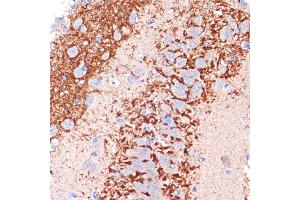 Immunohistochemistry of paraffin-embedded rat brain using Cadherin-13 (CDH13) Rabbit mAb (ABIN7265996) at dilution of 1:100 (40x lens).