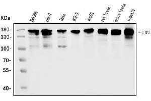 Western blot analysis of TJP2/ZO2 using anti-TJP2/ZO2 antibody (ABIN7602800).