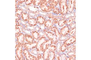 Immunohistochemistry of paraffin-embedded Rat kidney using PGD antibody (ABIN6127314, ABIN6145502, ABIN6145503 and ABIN6223639) at dilution of 1:100 (40x lens).