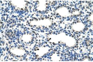 Human Lung; ARIH2 antibody - N-terminal region in Human Lung cells using Immunohistochemistry (ARIH2 anticorps  (N-Term))