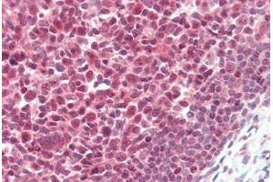 Human Tonsil (formalin-fixed, paraffin-embedded) stained with PARP1 antibody ABIN462086 followed by biotinylated goat anti-rabbit IgG secondary antibody ABIN481713, alkaline phosphatase-streptavidin and chromogen.